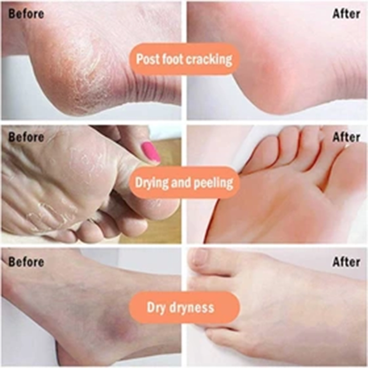 اسپری ترک پا Rako